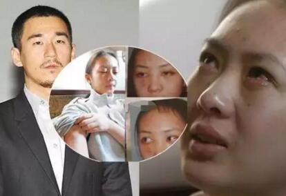 童瑶是张默殴打的人吗,童瑶被张默打是哪一年