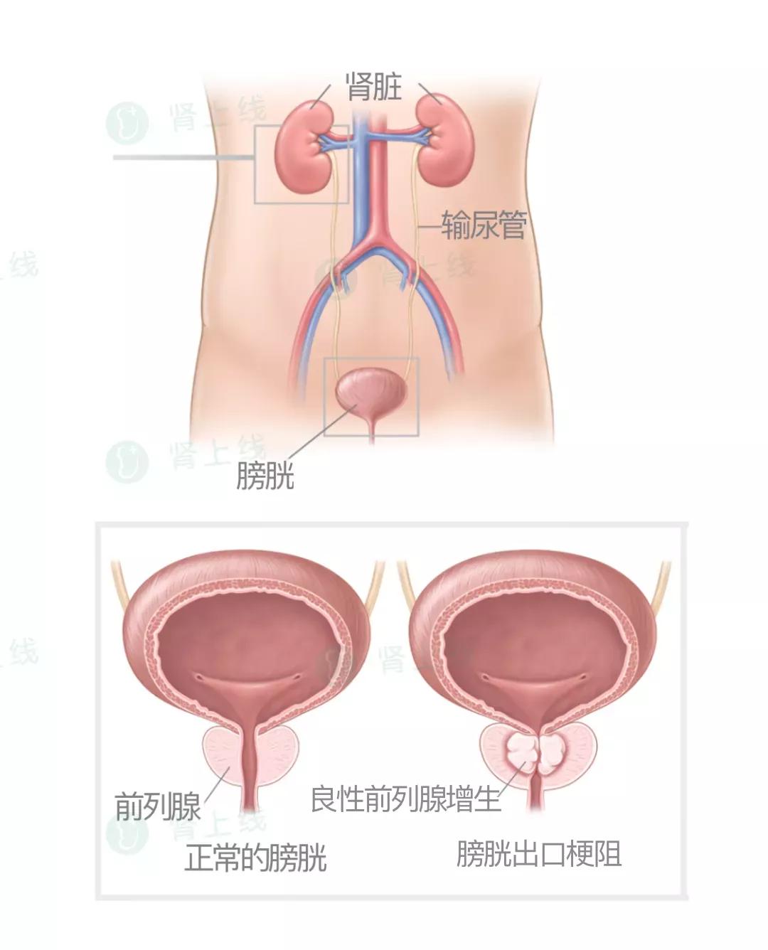 夜尿多是肾虚还是肾气不固,夜尿多不是尿频是什么原因