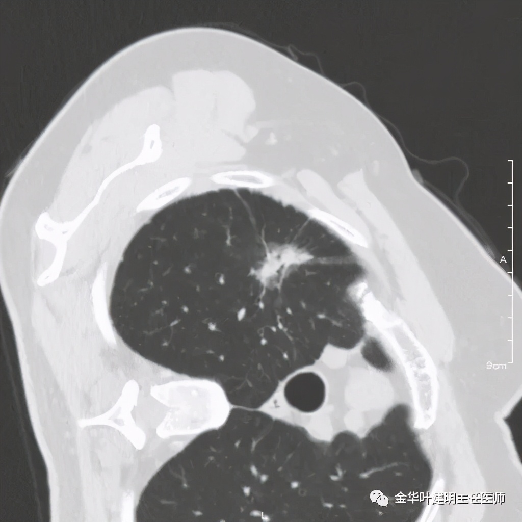 放个大招完整版教学,放个大招完整版前奏