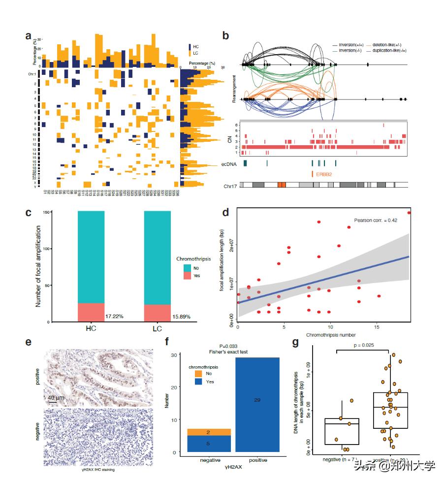 郑大一附院王立东,王立东食管癌
