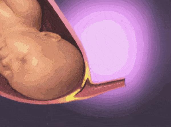 孕妇胎儿动图,3d动图视频怎么做