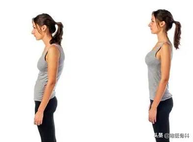 背背佳背后的秘密,20年前背背佳