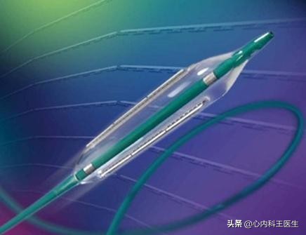 心脏支架4年了停阿司匹林行吗,冠心病放支架后仍然隐痛