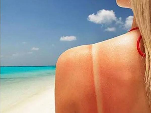 皮肤晒伤后起小疙瘩,皮肤晒伤后该怎么办