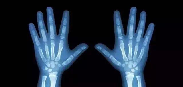 营养科暑假儿童少年减重班报名啦！科学控体重，健康成长促身高，中考高考生有免单机会！