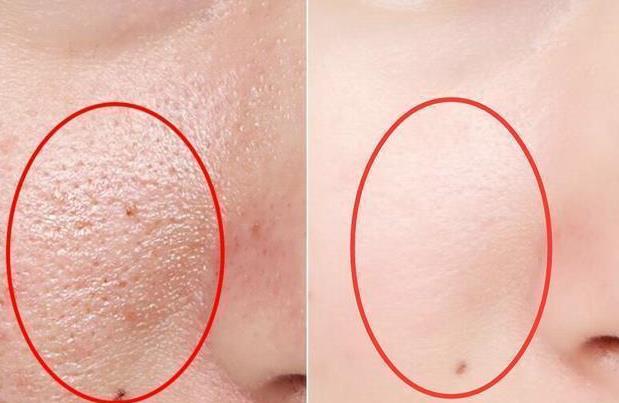 扎心了，时一时爽，用时火葬场，这5款单品，让你买了就后悔