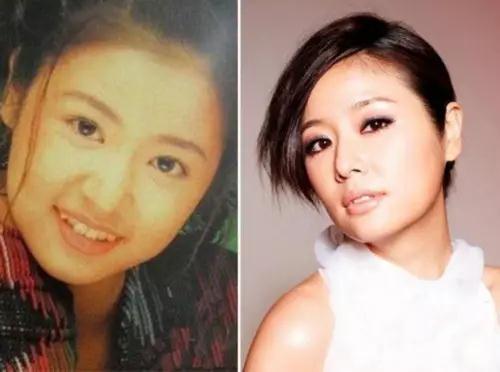 哪些明星整牙后像整容,明星整牙变美了