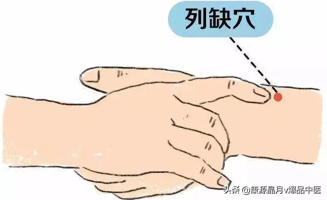 老外治疗偏头痛小妙招,国外治头痛的神奇方法