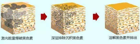 洗纹身健康科普,清洗纹身后需要注意什么