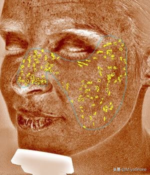 美白淡斑精华的正确使用方法,最有效的美白淡斑的方法