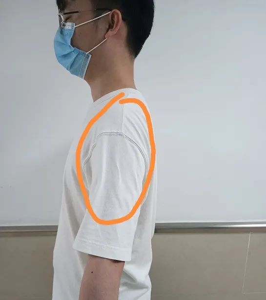 每天三个动作轻松治愈肩周炎,医生教你们肩周炎的最佳锻炼方法