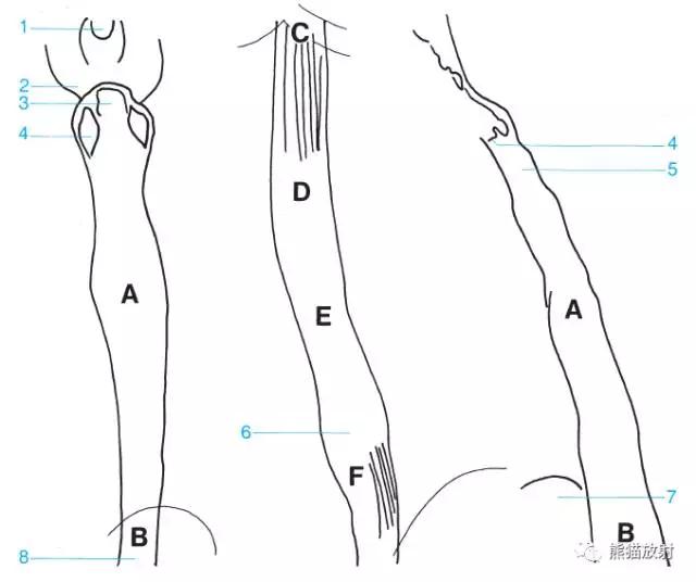 详细的消化道造影+彩色解剖图