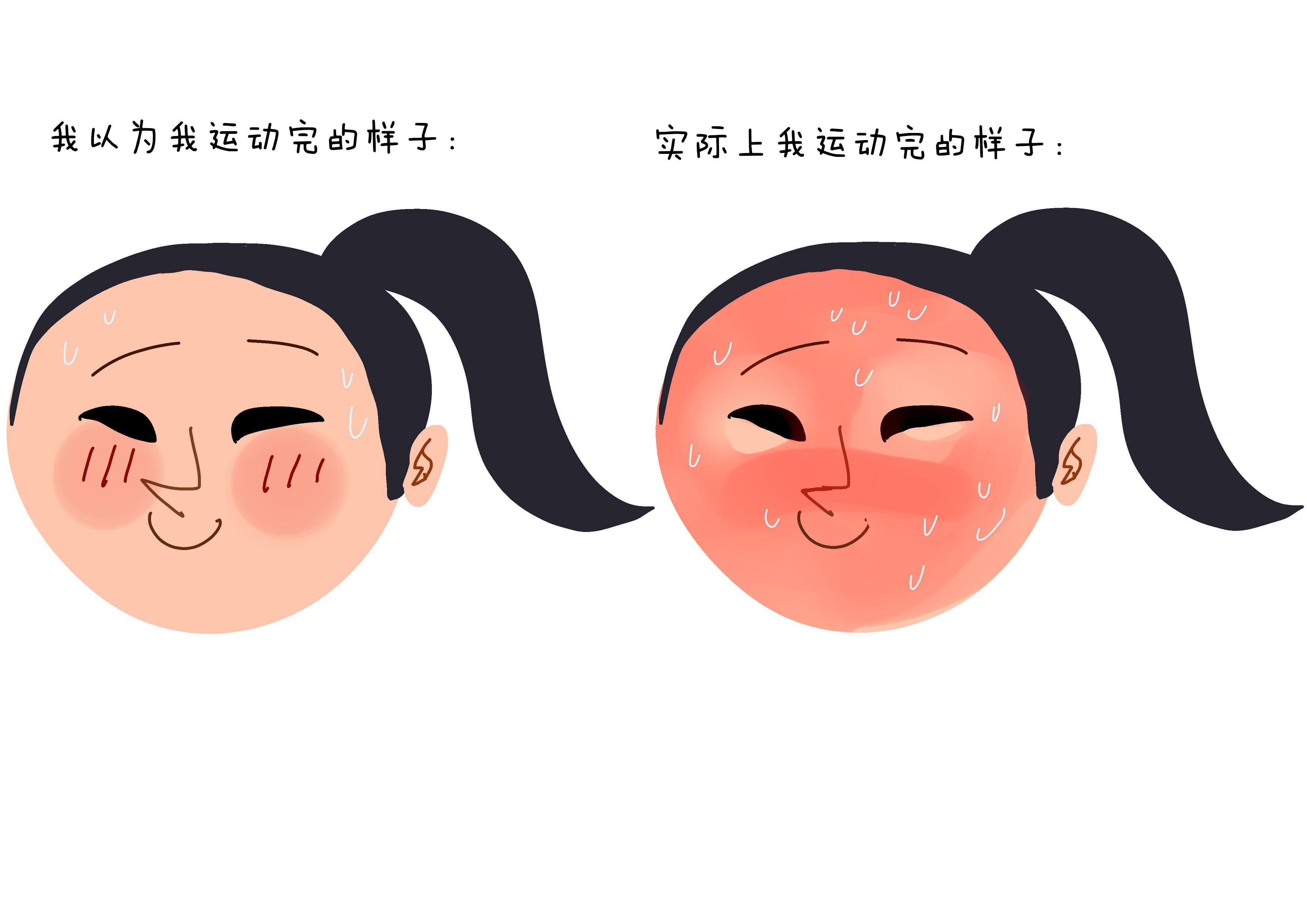 军训脸被晒黑晒伤怎么恢复,军训后晒伤晒黑怎么变白