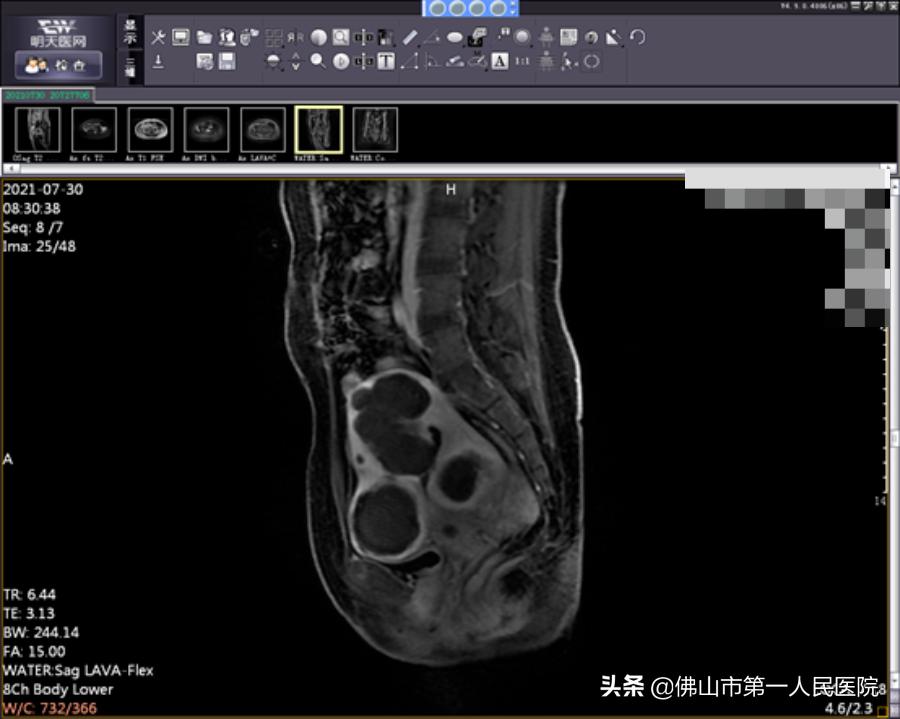 这把“刀”能隔山打“牛”,呵护子宫,带来好“孕”