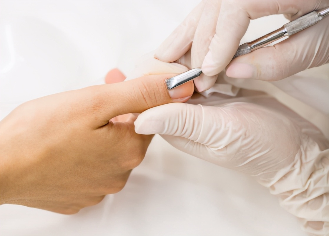 甲沟炎如何引起,甲沟炎是什么该如何预防