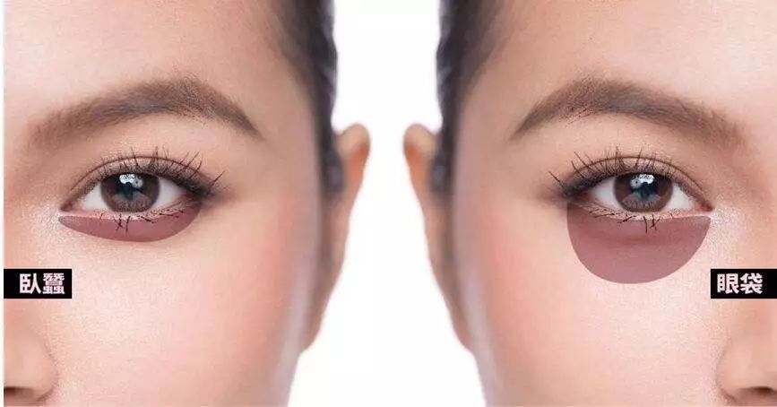 罗志祥的眼袋图片,罗志祥卧蚕眼真实照片