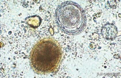 猫咪口渴、呕吐，除了肠胃问题，还有可能是得了蛔虫病