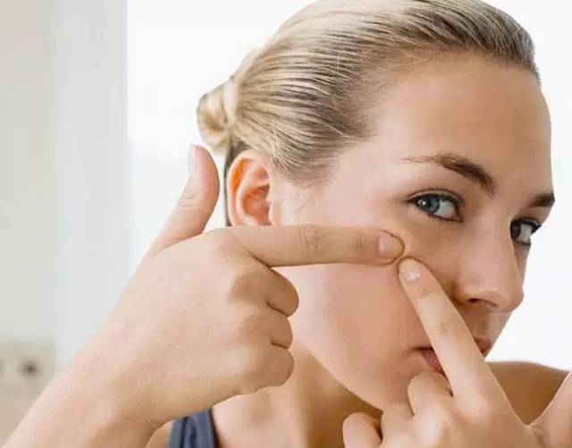 痘痘肌生活中有哪些需要注意的,痘痘肌护肤注意事项图片卡通