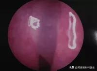 为啥来院就做内镜检查？医生怕是在骗我钱吧