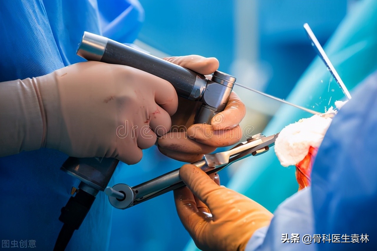 股骨头坏死手术后多久能恢复,股骨头坏死保髋手术恢复姿势视频