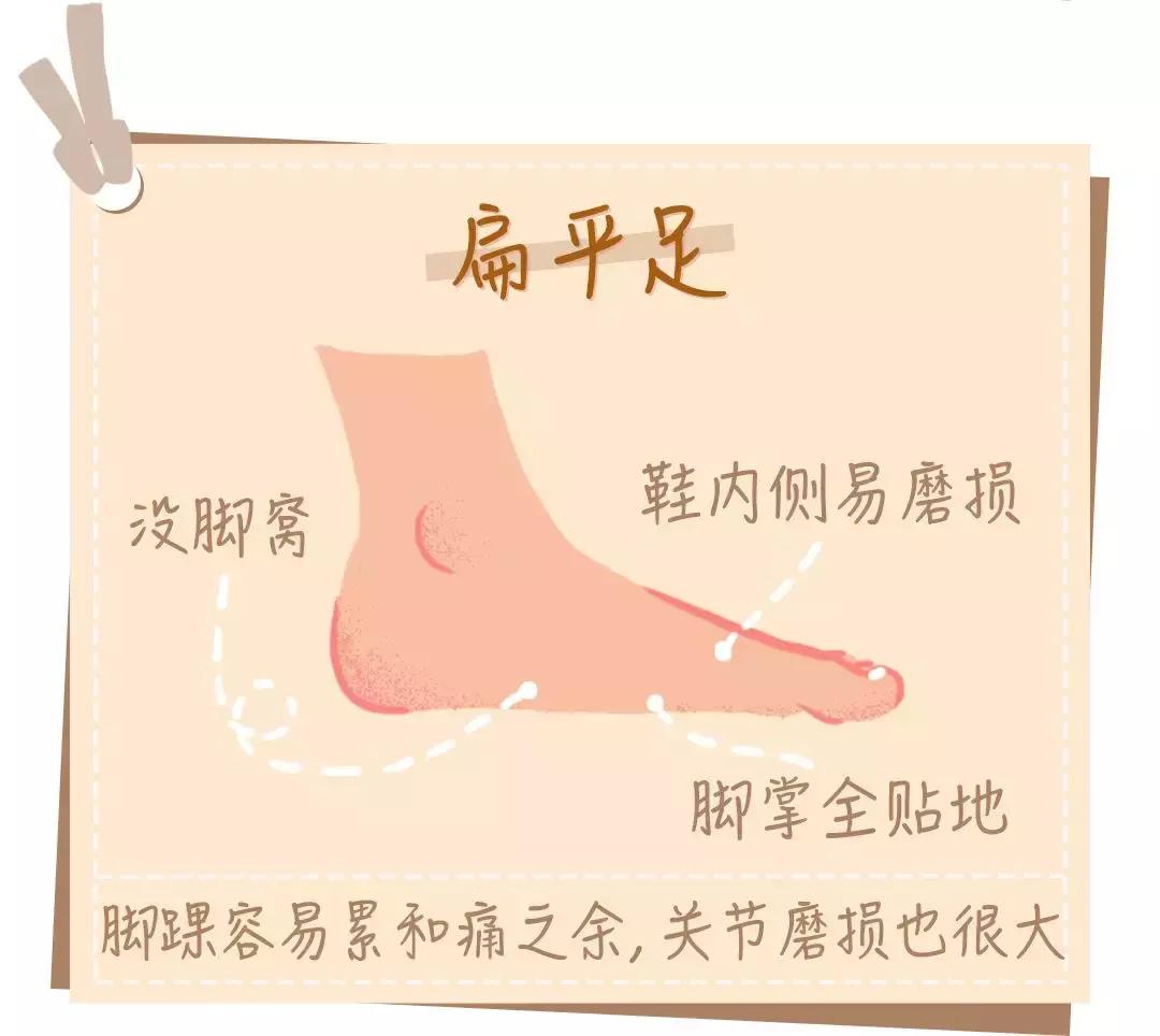 为什么穿鞋老磨脚,为什么鞋穿了一段时间又开始磨脚