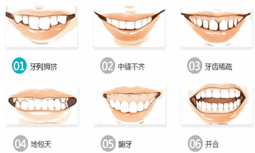 牙齿整齐但不对称,牙齿整齐就是不好看
