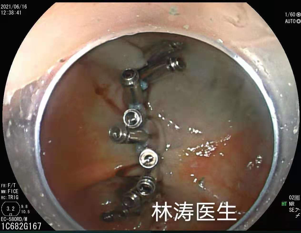 医学博士的忠告,医学博士曝光肿瘤过度治疗