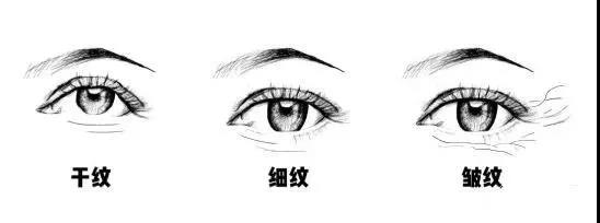 熬夜导致的眼部细纹用什么眼霜,熬夜导致眼部出现细纹怎么消除