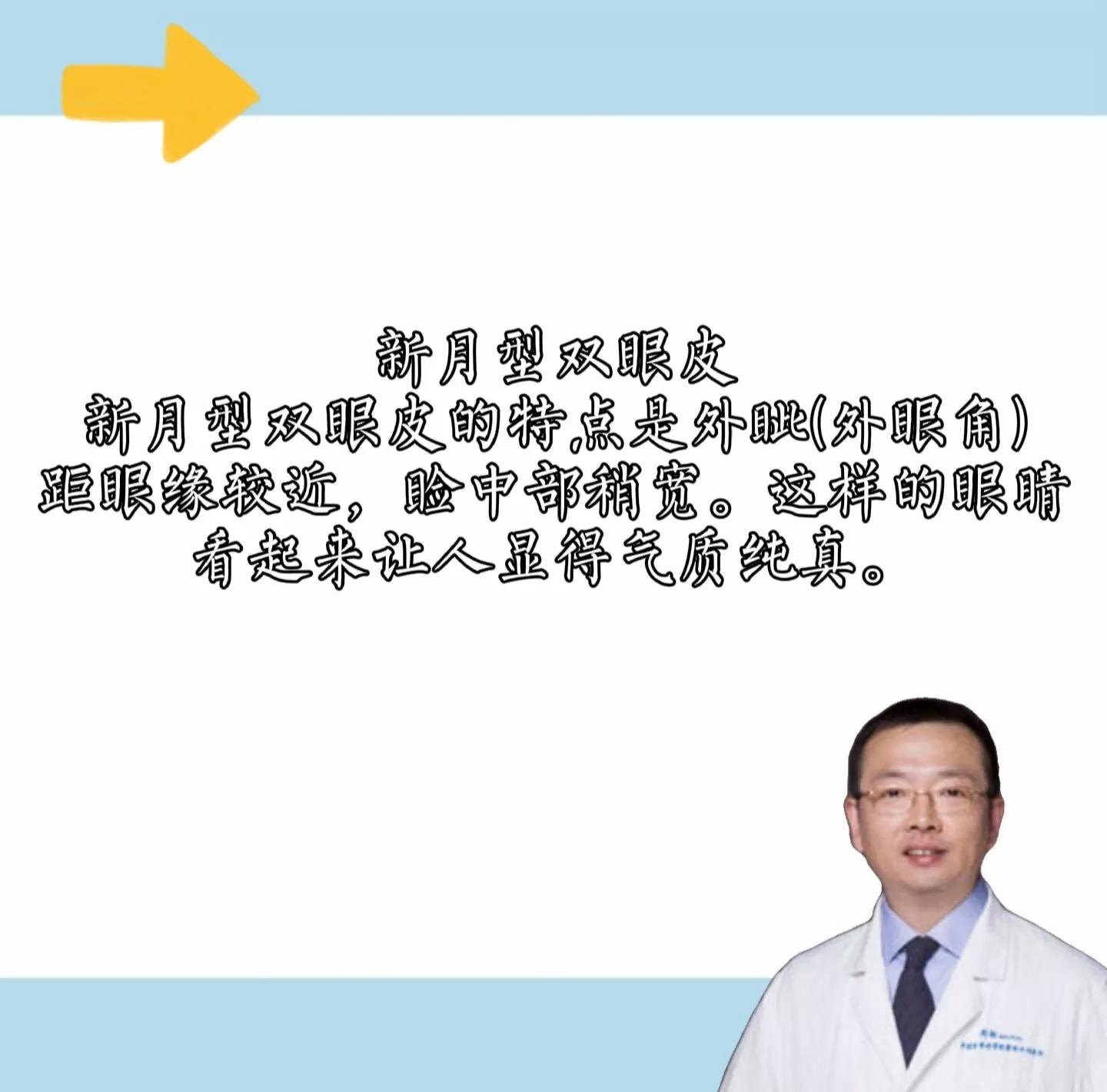 双眼皮类型有哪些及其图片,双眼皮常见的几种类型