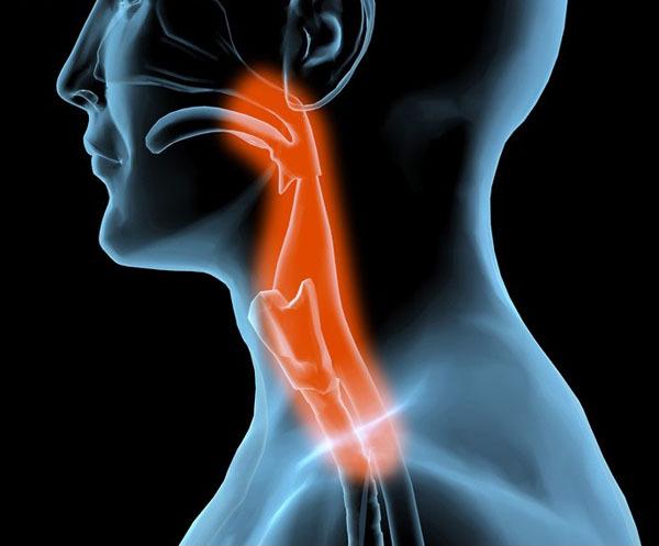 咽炎老不好是不是怀疑食管癌,食管癌可引起喉咙上火