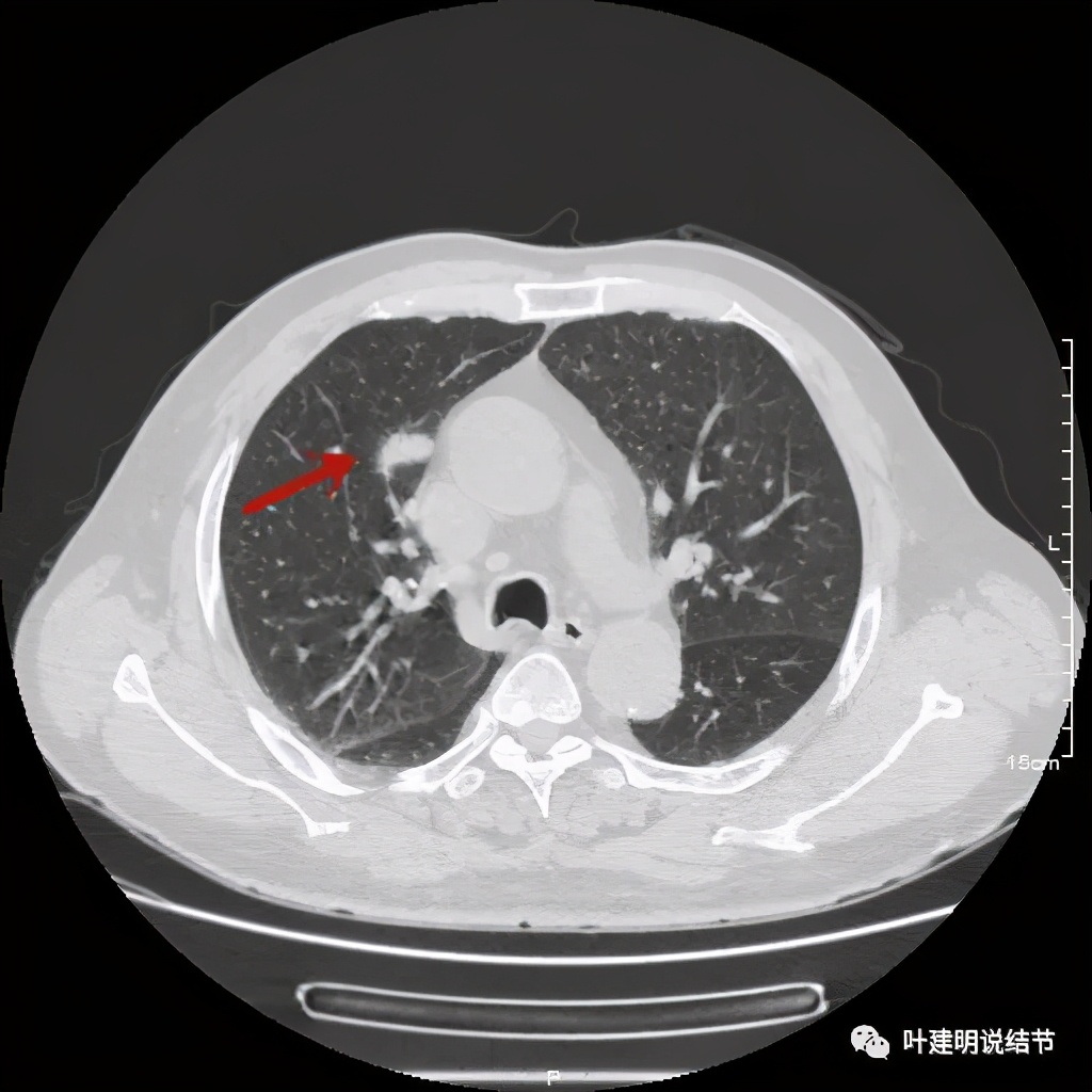 误诊报告图片,误诊案例及案例分析