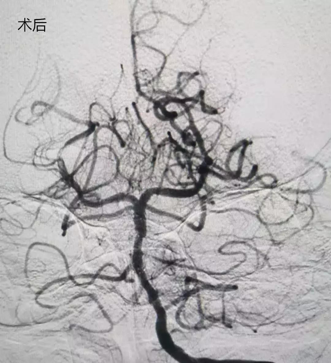 郑州中康医院新院区最新进展,郑州中康医院项目最新进展