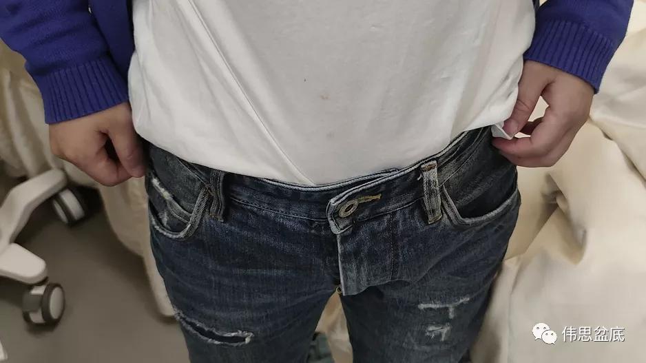 产后3年做腹直肌修复还有效果吗,产后3年做腹直肌修复还有用吗