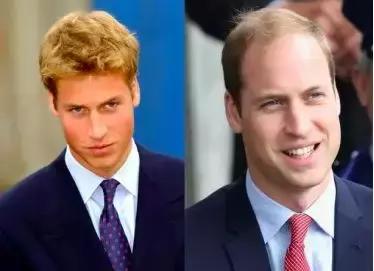 在澳洲逃不过脱发秃头?权威博士说只要吃这5种水果