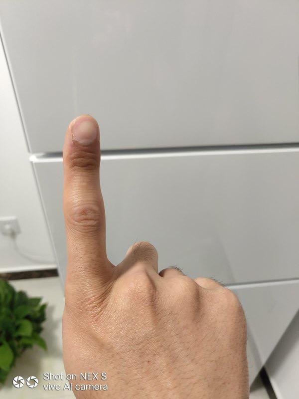 自觉心里不舒服是焦虑症吗,焦虑症总是自觉身体不适