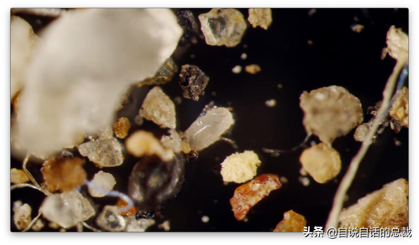 毛囊异型,毛囊里的异形物