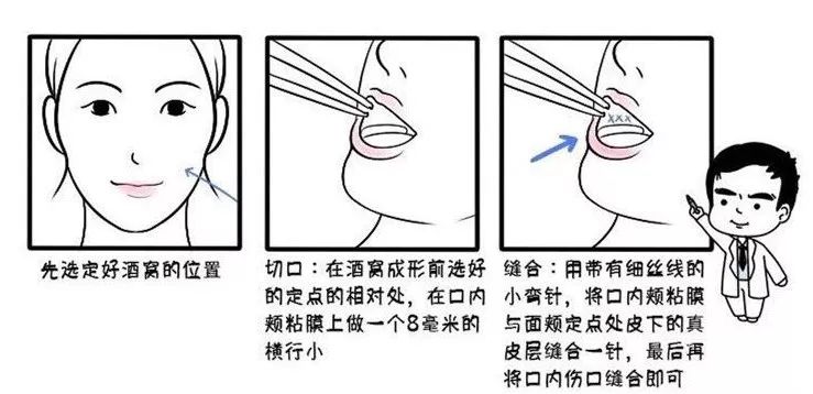 杨紫脸上小酒窝,杨紫林俊杰现场演唱会