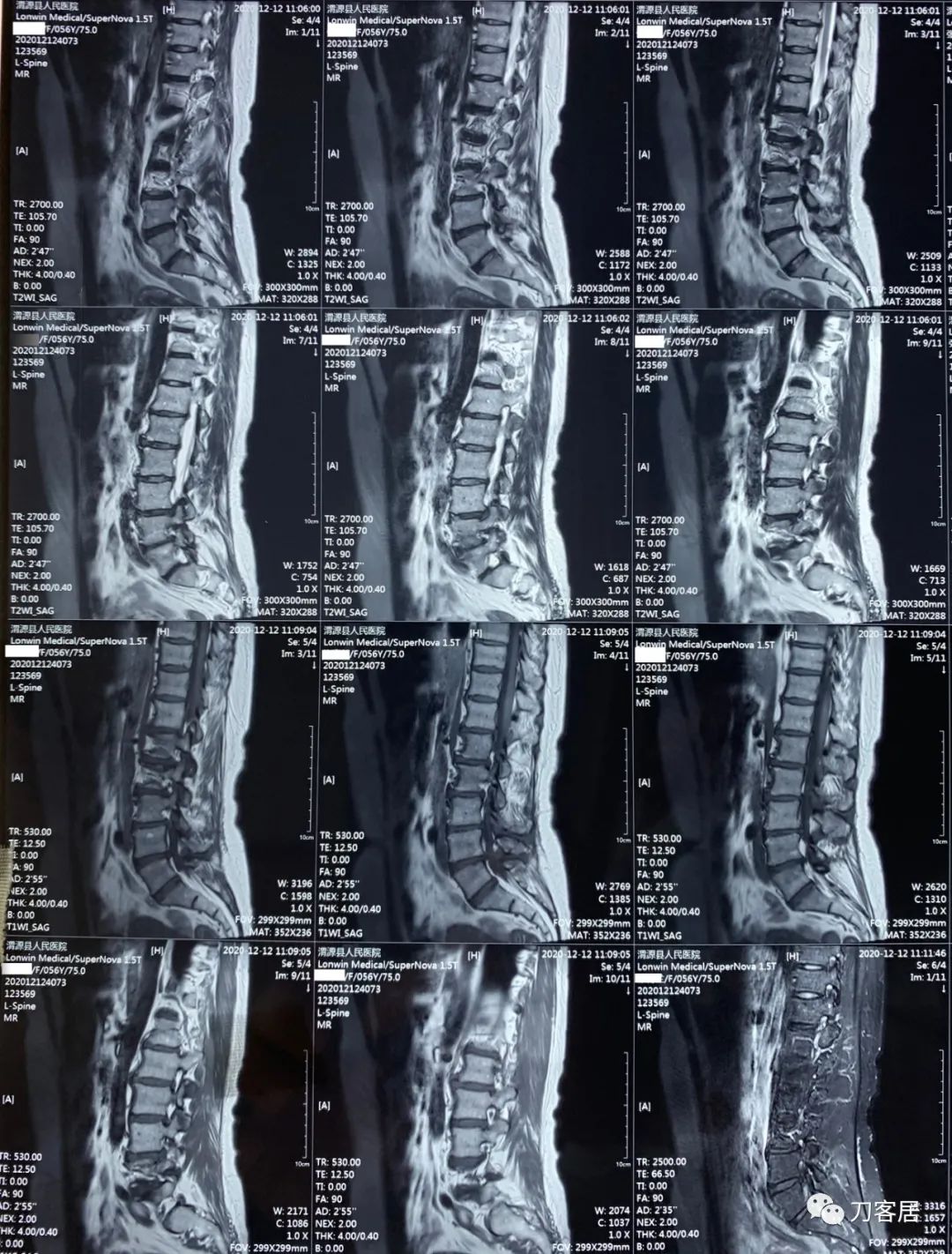 我的门诊病历,我的门诊