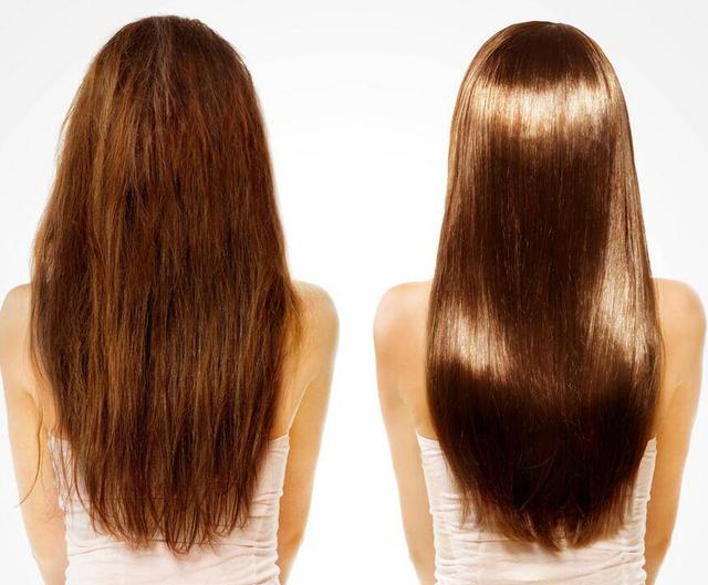 脱发怎么补气血养毛囊,毛囊营养不良脱发