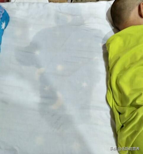 儿童夏天满头大汗的原因,夏季孩子老是出汗怎么回事