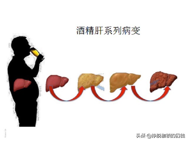 喝酒真的能喝死人么,喝酒能直接导致死亡吗