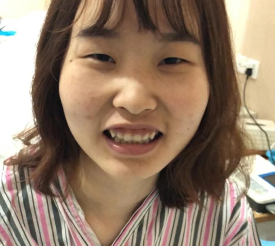 平价祛痘好物测评:理肤泉K乳见效快,红霉素软膏去闭口超赞