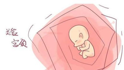 宫颈息肉有什么明显的症状,宫颈息肉会有哪些症状