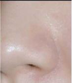 打败毛孔!下一个反孔精英就是你!