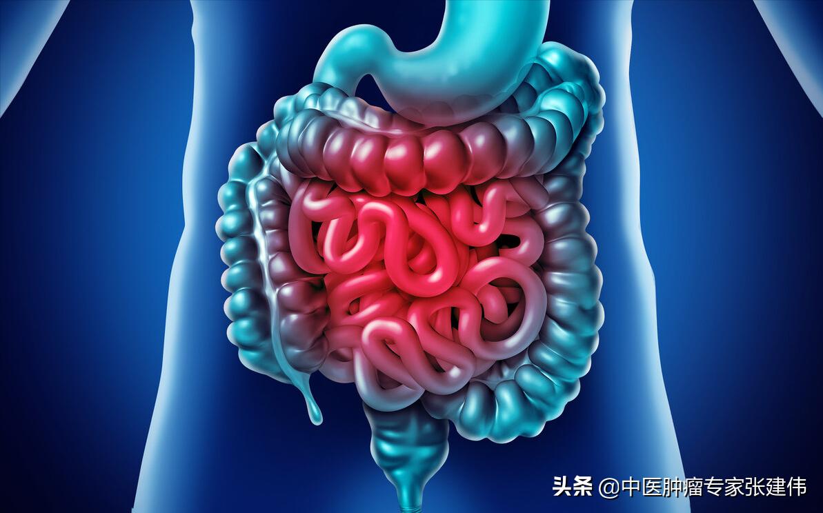 便秘可能是肿瘤发出的警惕信号,便秘查出癌症