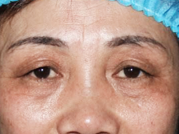 sizzix日本双眼皮定型霜,双眼皮定型霜怎么归类