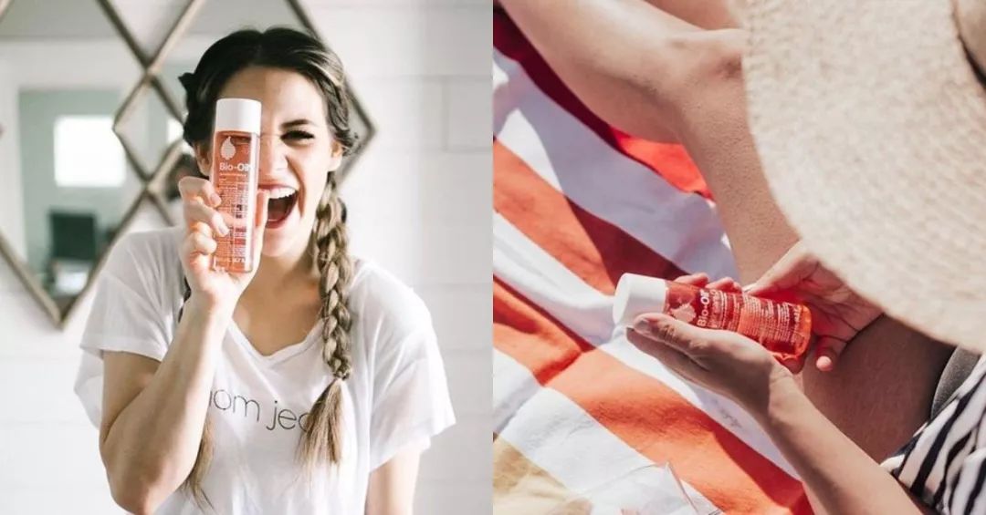 去妊娠纹的神油百洛油，竟然还有这8大用处？