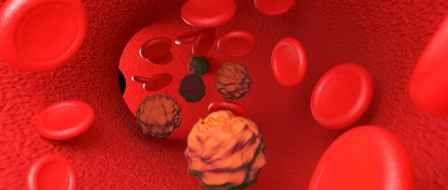 宫颈癌肺转移吃靶向药能活多久,宫颈癌靶向药可以治愈吗