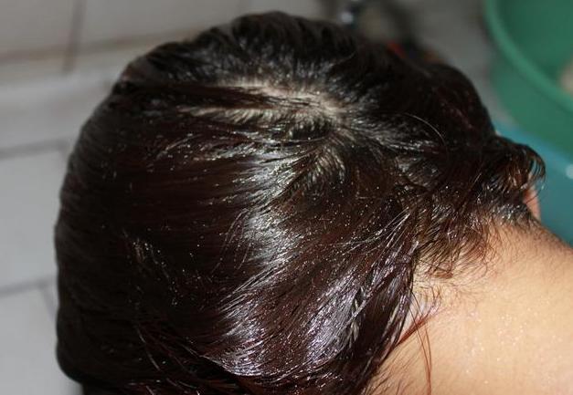 为什么洗头的时候头发掉得特别多,每次洗头梳头都掉很多头发怎么办