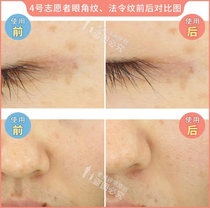 300块的网红美容仪有效果吗,网红家用美容仪测评